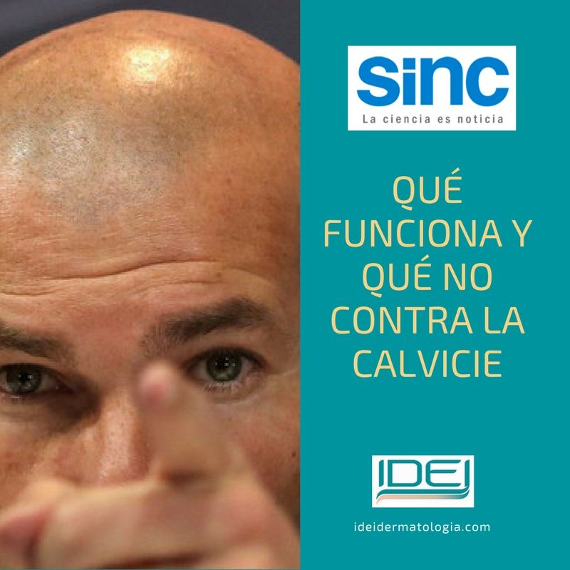 Qué funciona y qué no contra la calvicie