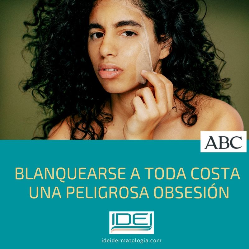 Blanquearse la piel. Una peligrosa obsesión
