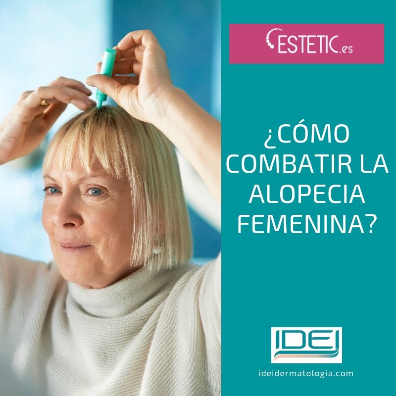 Cómo combatir la alopecia femenina