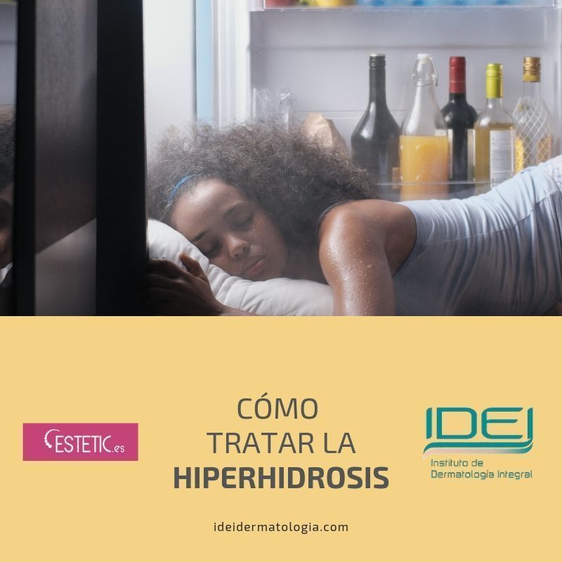 Cómo tratar la hiperhidrosis