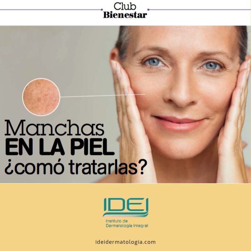 Manchas en la piel ¿cómo tratarlas?