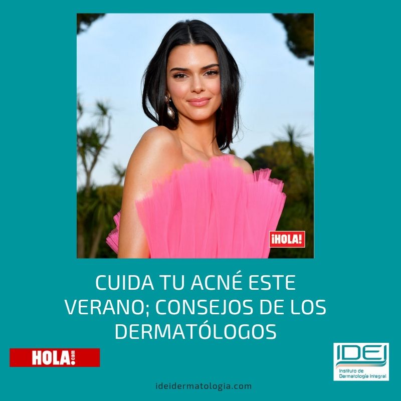 Cuida tu acné este verano; consejos de los dermatólogos