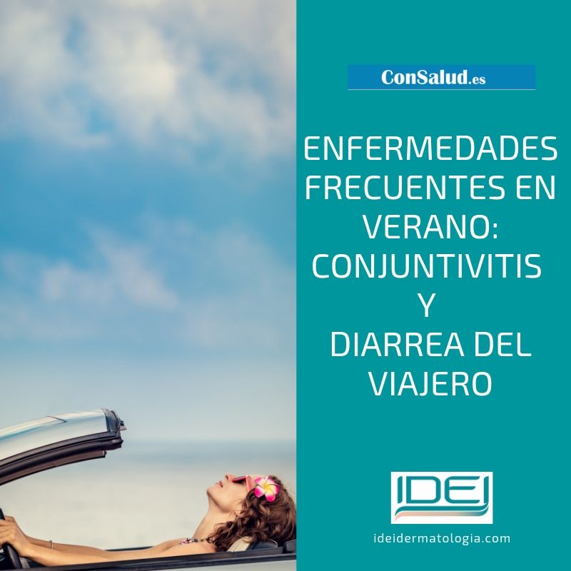 queratitis actínica y pitiriasis versicolor. Enfermedades frecuentes en verano