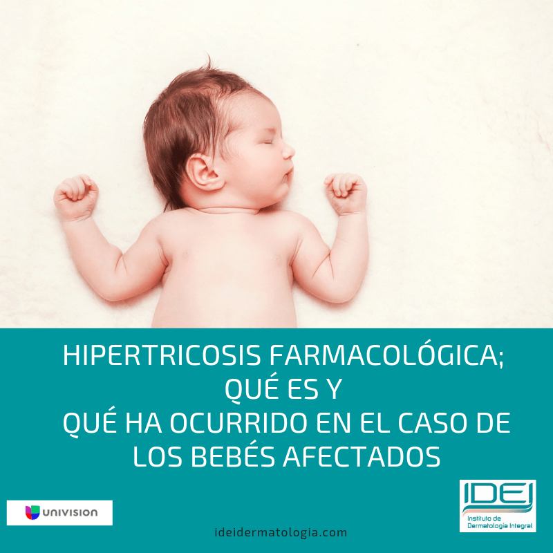 Hipertricosis farmacológica; qué es y qué ha ocurrido en el caso de los bebés afectados
