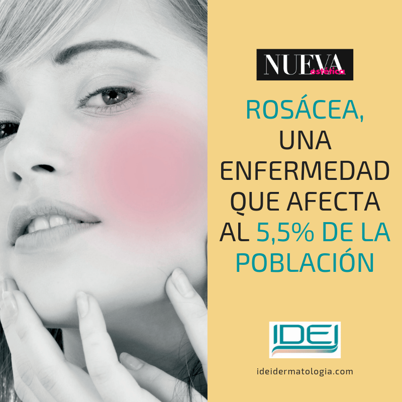 Rosácea, una enfermedad que afecta al 5,5% de la población