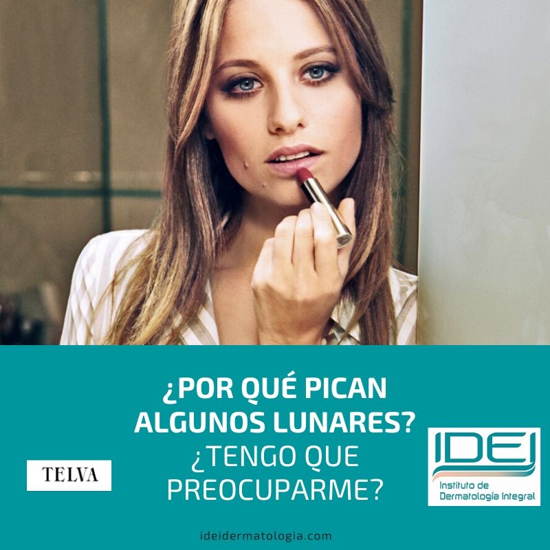 Algunos lunares pican ¿tengo que preocuparme?