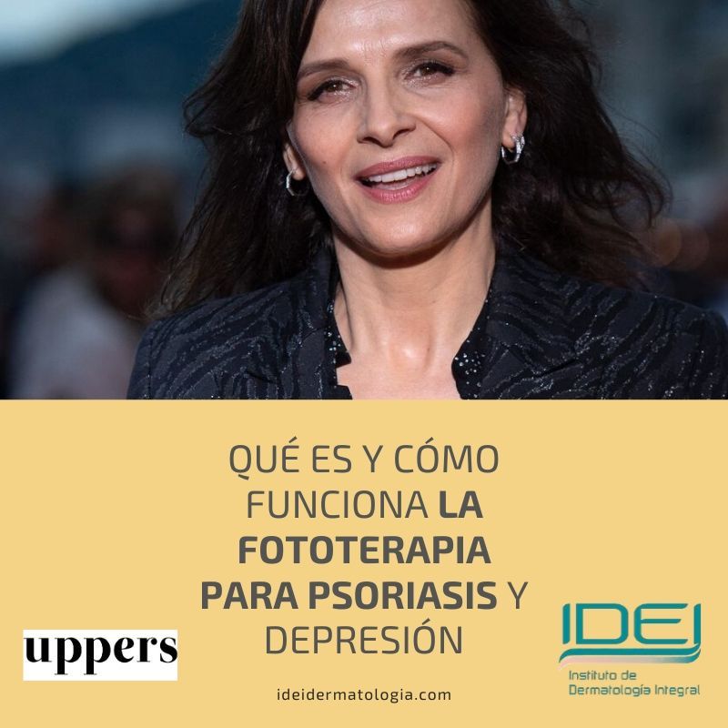 Qué es y cómo funciona la fototerapia para psoriasis y depresión