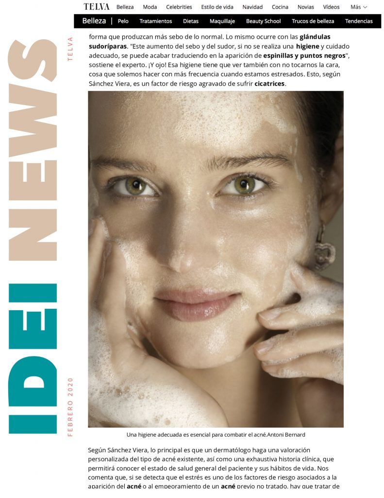 acaba con el acne de forma definitiva