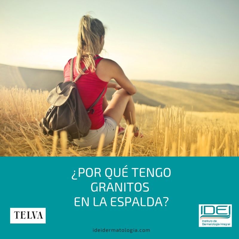 Por qué tengo granitos en la espalda