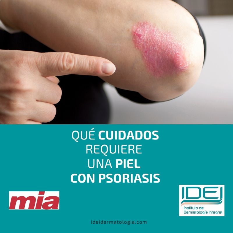 Qué cuidados requiere una piel con psoriasis