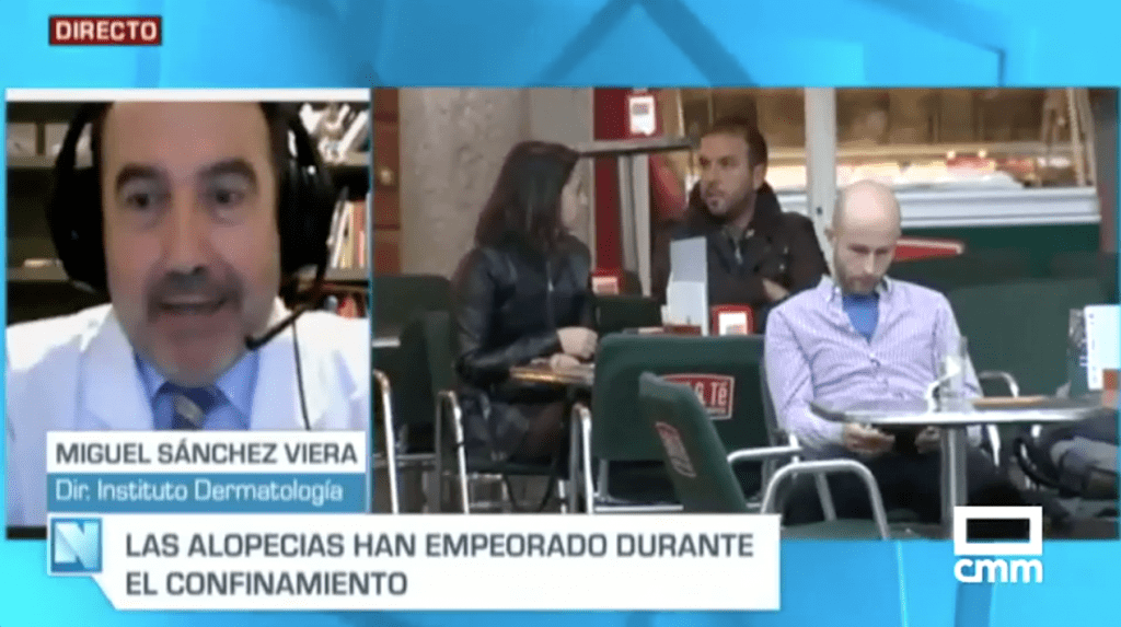 Las alopecias han empeorado durante el confinamiento