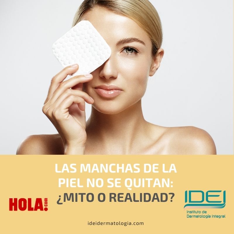Las manchas de la piel no se quitan_ ¿verdadero o falso?
