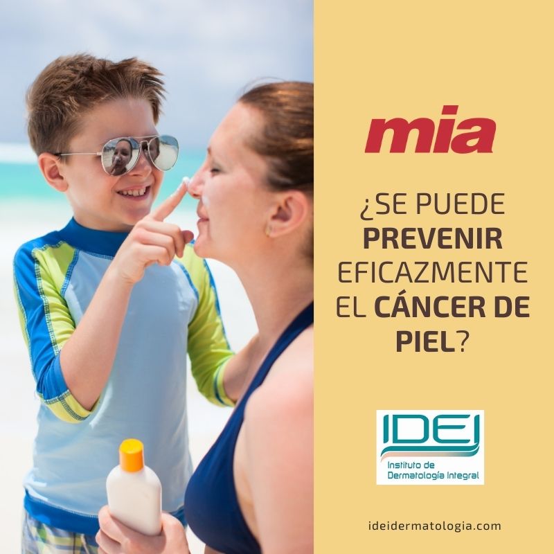 Se puede prevenir eficazmente el cáncer de piel