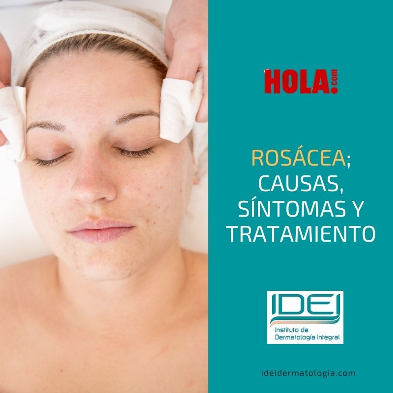 Causas, sintomas y tratamiento de la rosacea