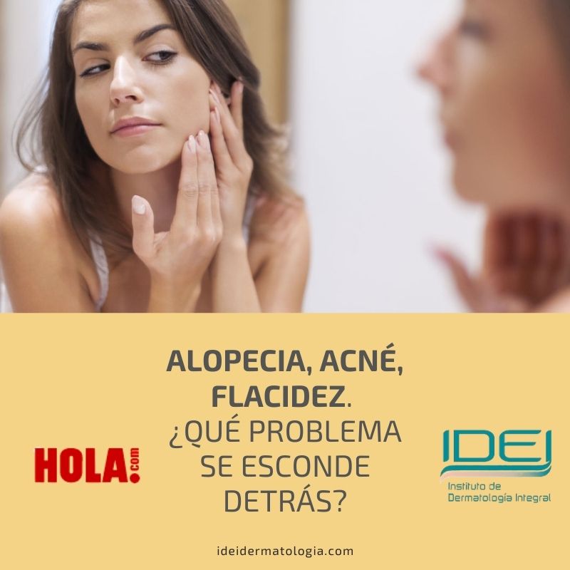 Alopecia, acné, flacidez. ¿Qué problema se esconde detrás?