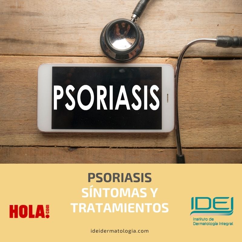 Psoriasis, síntomas y tratamientos