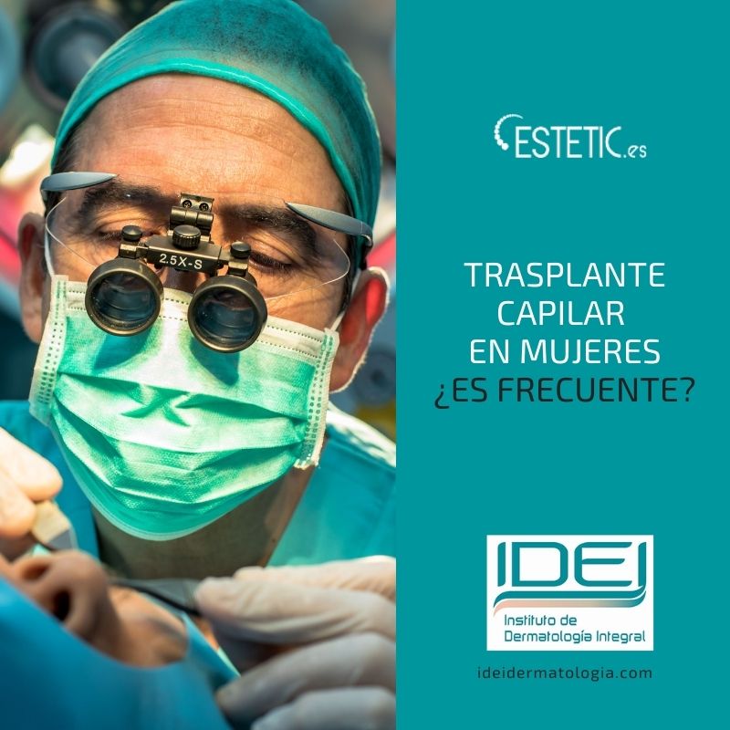 Trasplante capilar en mujeres