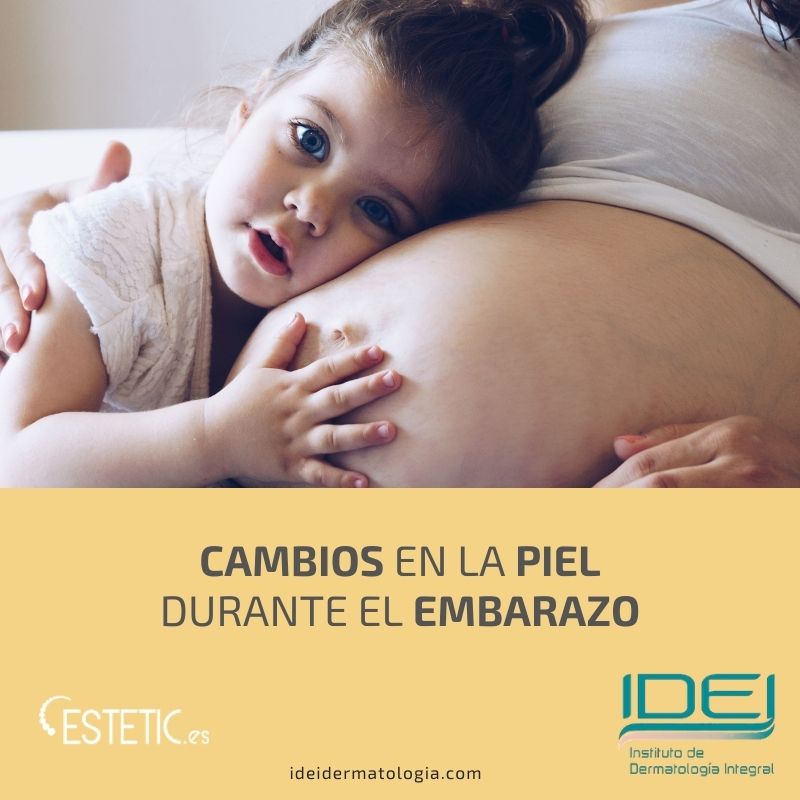 Como cambia tu piel durante el embarazo