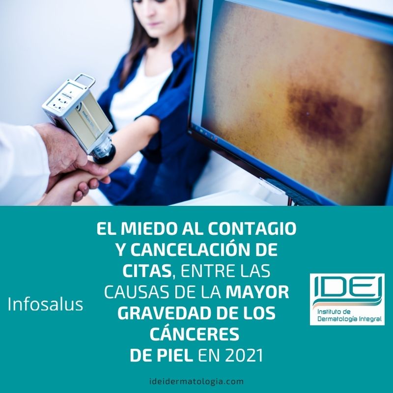 El miedo al contagio y cancelación de citas, entre las causas de la mayor gravedad de los cánceres de piel en 2021