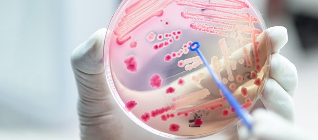 disbiosis-microbiota
