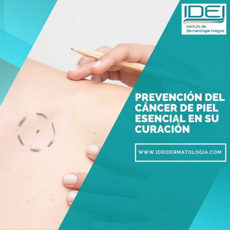 El diagnóstico precoz del cáncer de piel es esencial en su curación