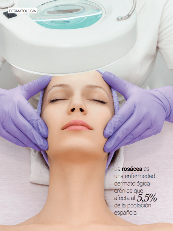 Rosácea es una enfermedad dermatológica crónica